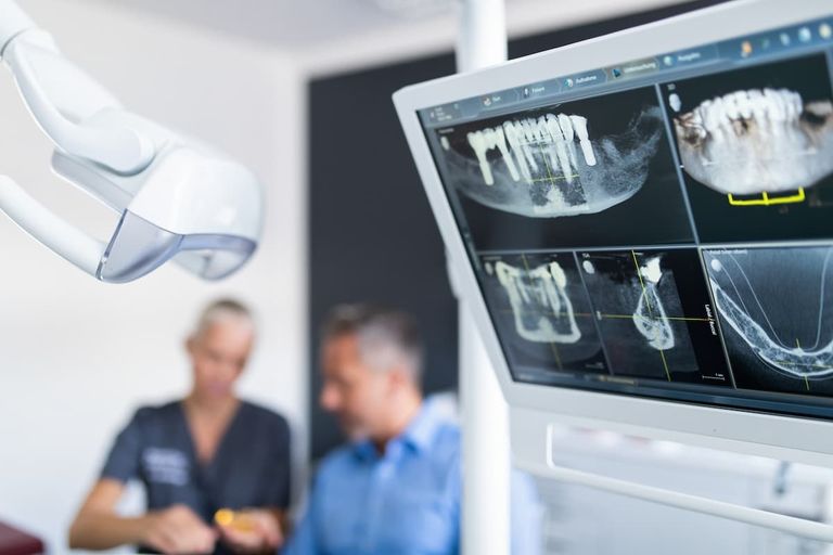 Brücke oder Implantate?